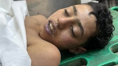 مصرع طفل غرقا في ترعة بنطاق مركز شرطة بلبيس في الشرقية 