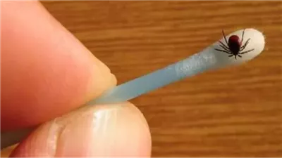 بعد إصابة أول حالة بدودة 