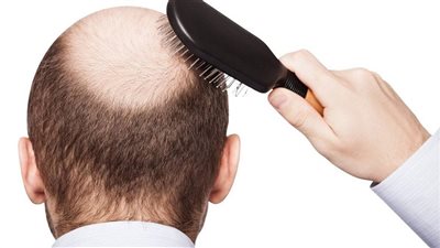 من تساقط الشعر إلى نزيف اللثة.. 8 علامات تؤكد حاجتك لتناول الفيتامينات