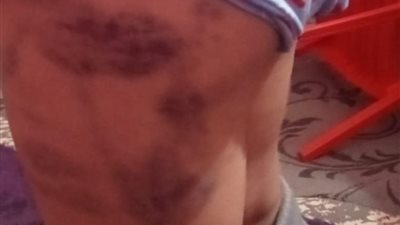 صغير يتعرض للاعتداء في مزرعة ماشية بقطور على يد مراهق 