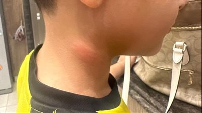 أم تستغيث بعد اعتداء مدرس على ابنها المريض بمدرسة خاصة