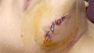 درس خصوصي يتحول لكابوس بسبب مروحة قاتلة في العمرانية