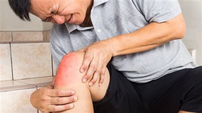 ودعي الانتفاخ سريعا.. عادات يومية تُخفف من تورم الجلد بعد حوادث التصادم