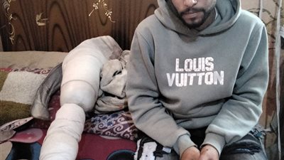 فقد قدمه في حادث.. عمر يناشد الرئيس السيسي: أخويا مريض ونفسي أجيب توكتوك