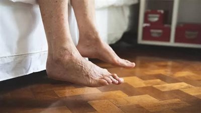 طبيب يكشف لـ نيوز رووم مرض القدم السكري وطرق الوقاية منه