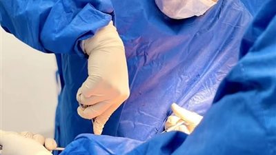 استغرقت 6 ساعات .. استئصال ورم خبيث لمريض من قطاع غزه بمستشفيات جامعة أسيوط