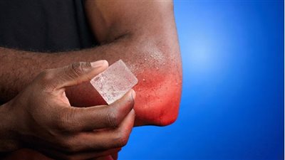 تحذير طبي .. الثلج ليس علاجًا آمنًا للحروق وقد يُفاقم الإصابة