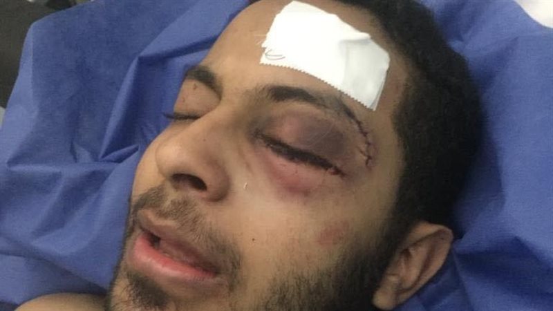 المجنى عليه