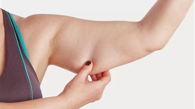 الزنود: معركة التخلص من دهون الذراعين… الأسباب والحلول الآمنة