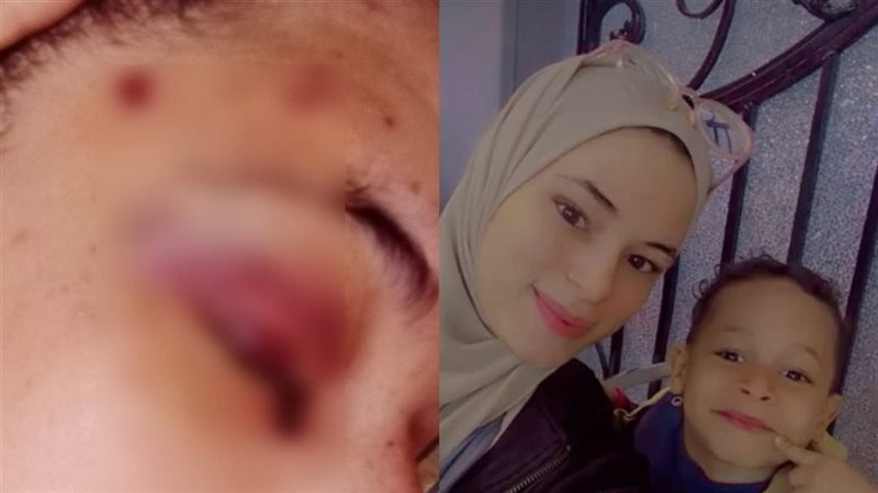 أسماء ضحية تعدي طليقها