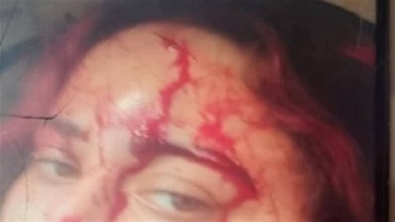 آثار التعذيب