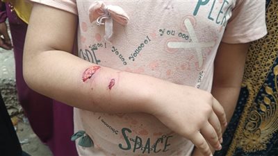 «السلعوة» تعقر وتصيب 7 أطفال فى حى الصوفى  بمحافظة الفيوم | صور 