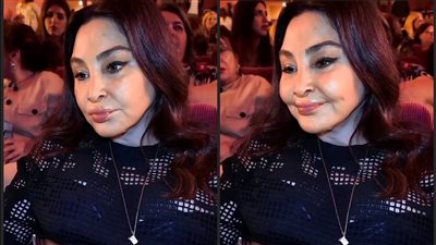 هل غيرت إليسا شكلها؟ أطباء التجميل يشرحون 