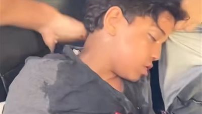 إصابة طفل بحادث تصادم سيارة خلال مروره الطريق بالإسماعيلية